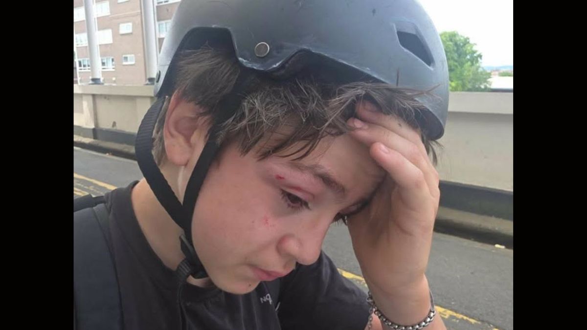 Worcester teen attack